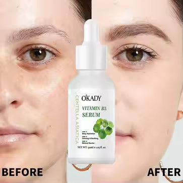 O'KADY Centella Asiatica Vitamin B5 Serum